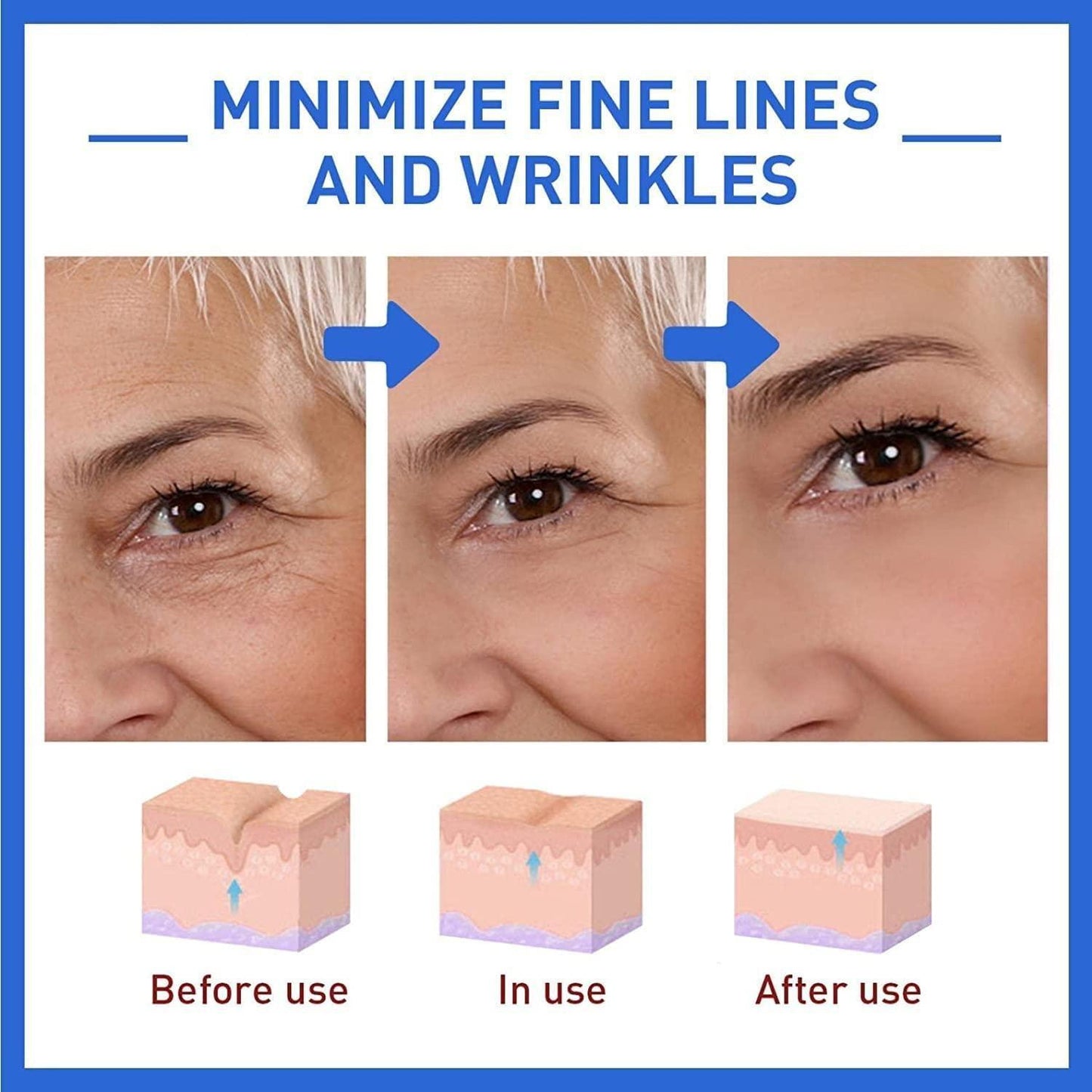 Lywire™ YouthRenew Botox Serum