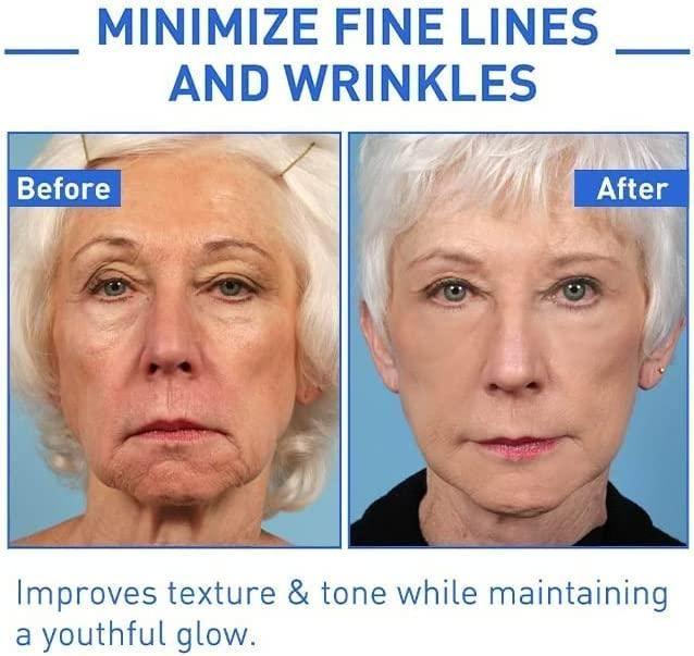 Lywire™ YouthRenew Botox Serum